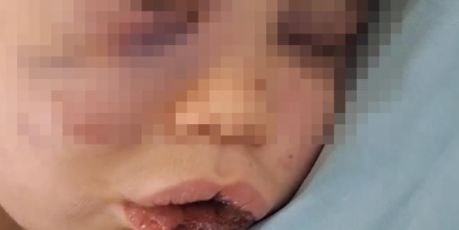 Annesinin sevgilisi bebeği öldüresiye dövdü!