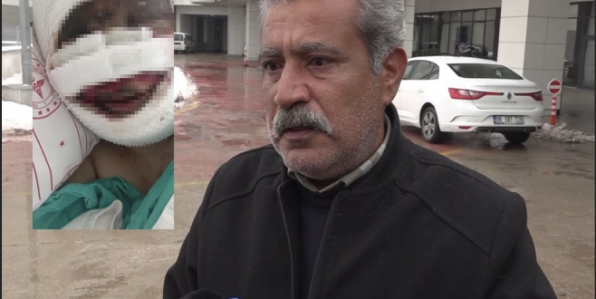 Eski eşi tarafından vahşete uğrayan kadın o anları anlattı, acılı baba sert tepki gösterdi