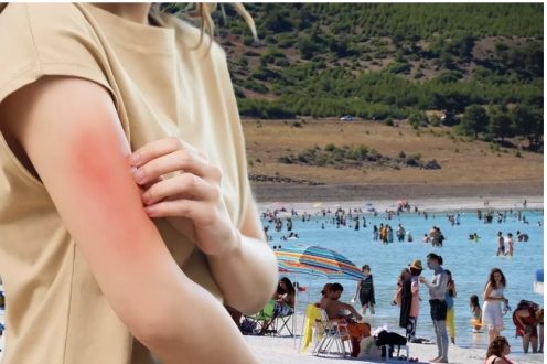 Et yiyen bakteri vakası Türkiye'de görüldü mü? Bakanlıktan açıklama