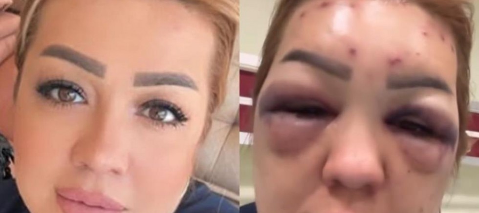 Güzelleşmek isterken hastanelik oldu!