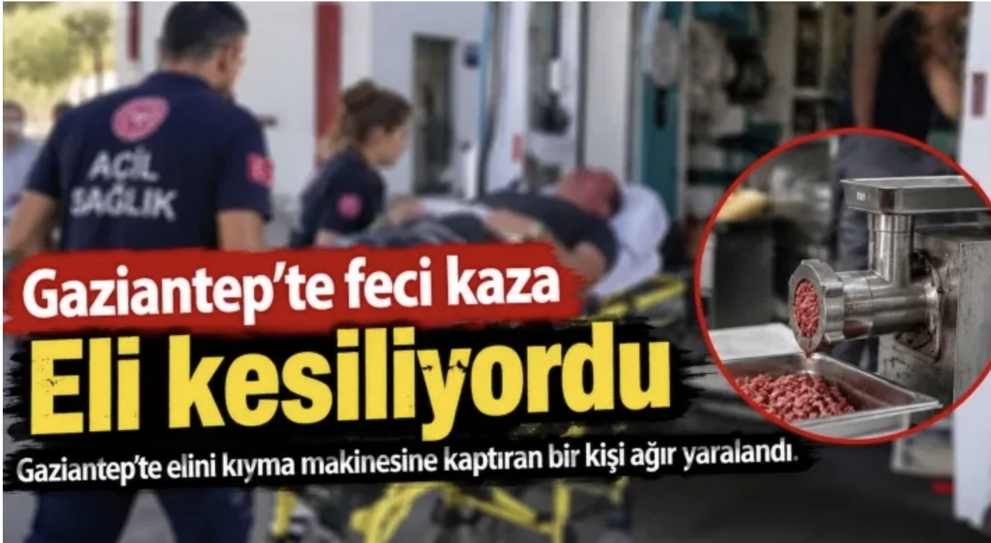 Gaziantep'te feci kaza: Eli kesiliyordu