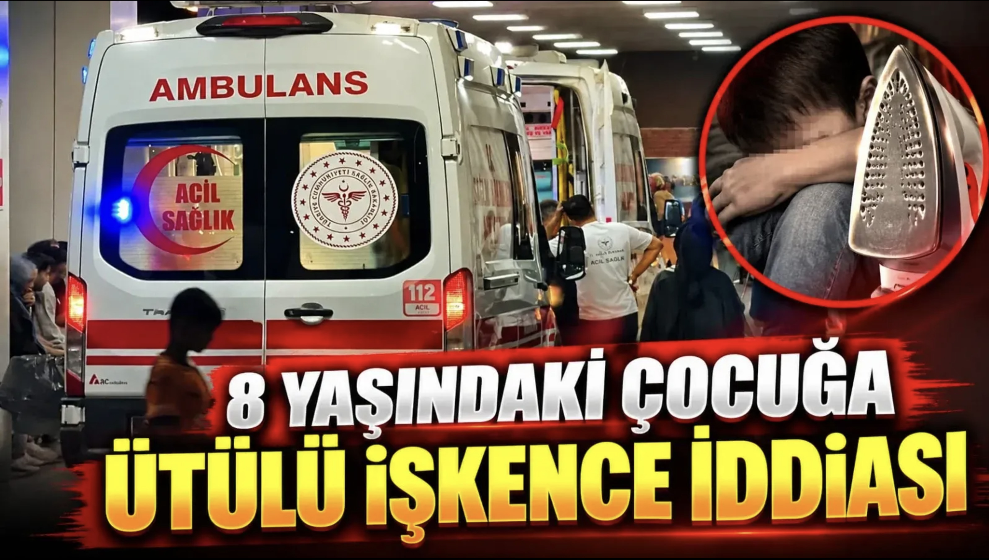 Küçük çocuğa aile boyu ütüyle işkence