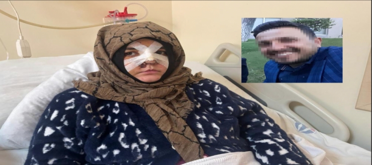 “Ölümden Son Anda Kurtuldu”