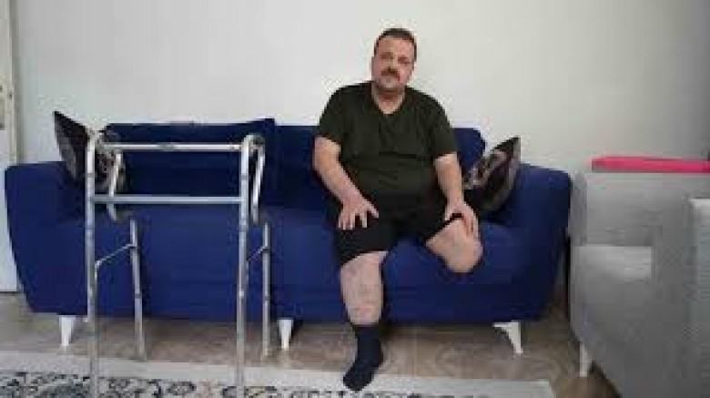 Terapi sonrası felaket: Tedavi için gitti, ayağı kesildi